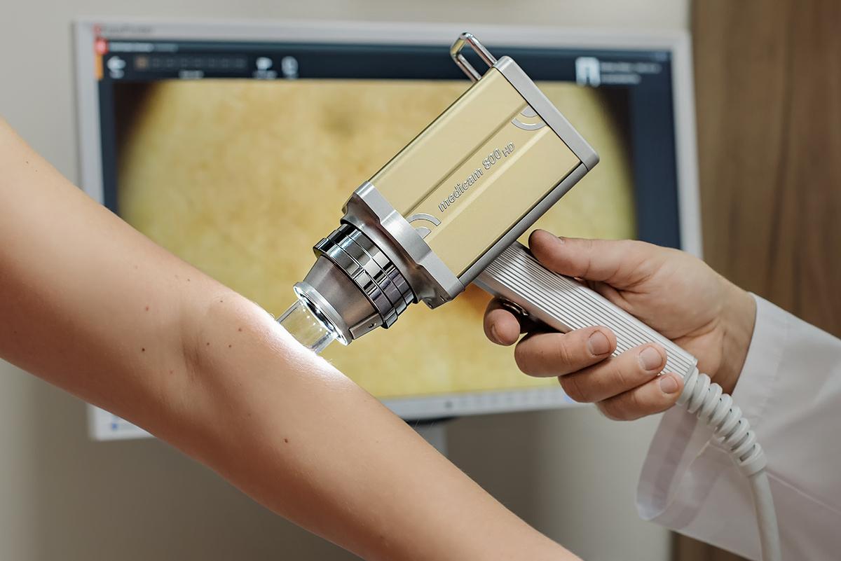 Wideodermatoskopia